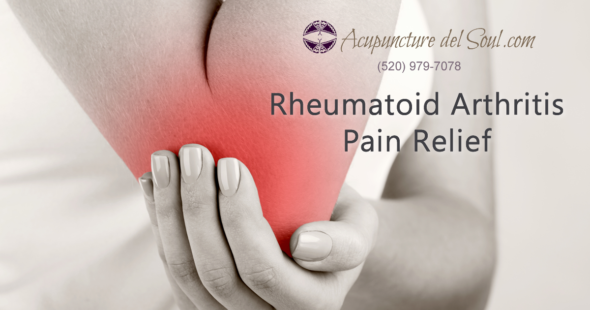 Rheumatoid Arthritis Pain Relief